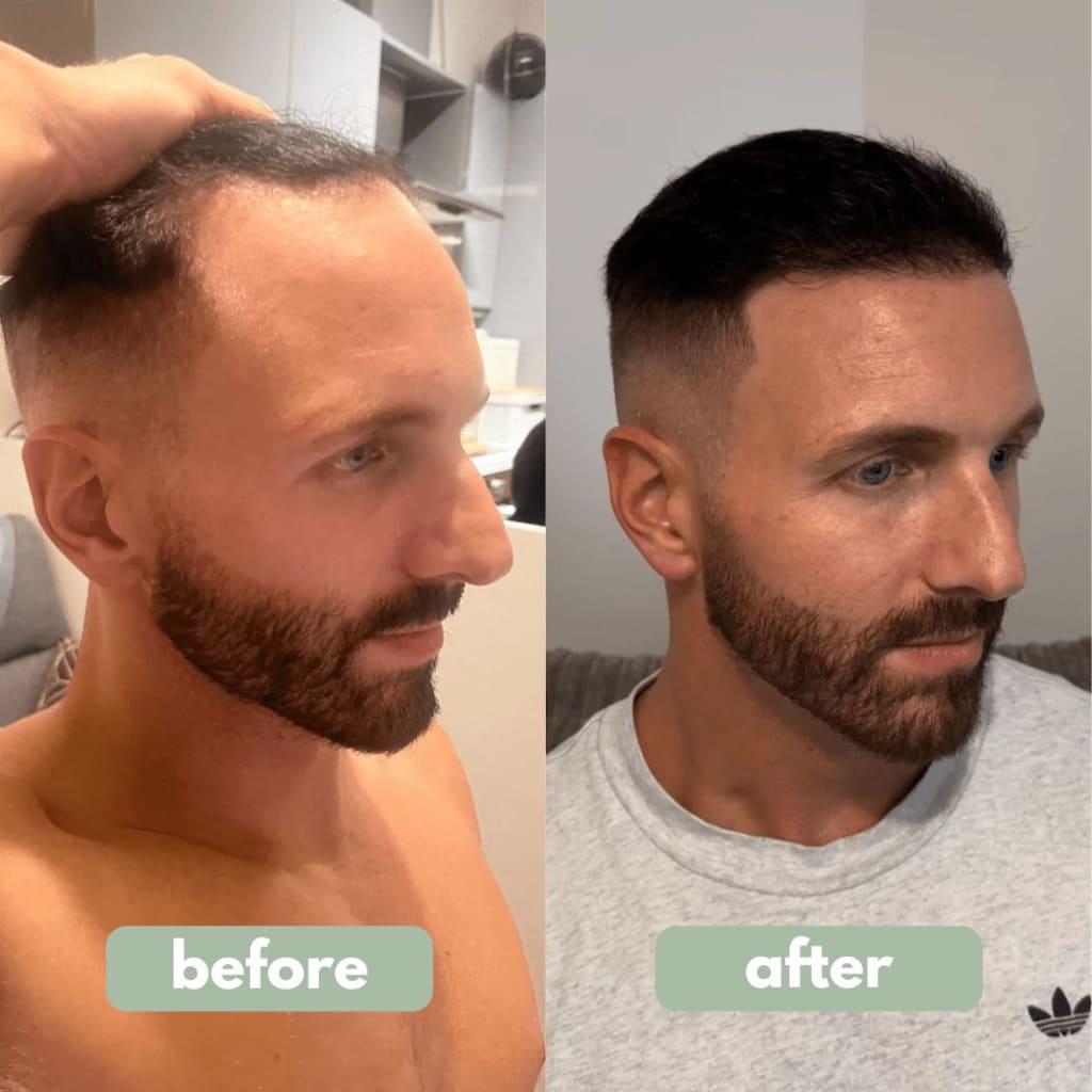 Trueblend Hair Growth Serum