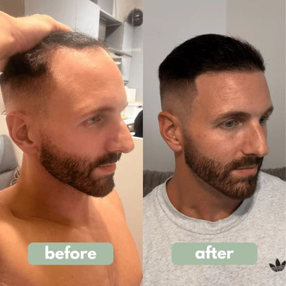 Trueblend Hair Growth Serum